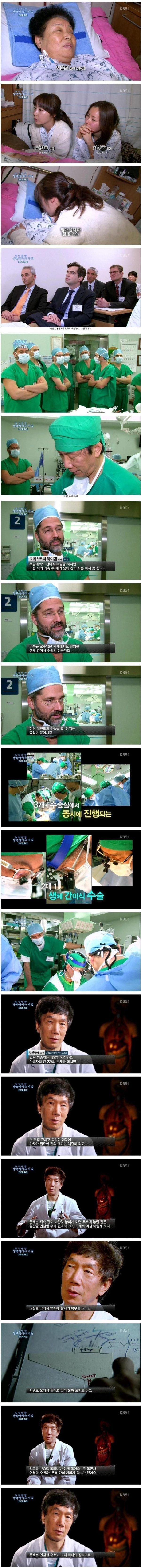 세계 최고의 간이식 수술 전문가의 위엄